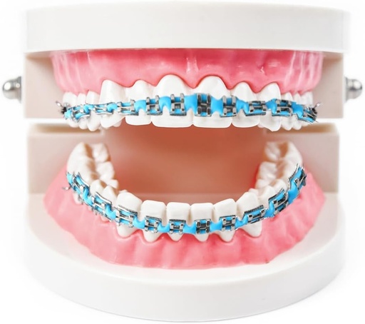 Aparate dentare false, aparate dentare, aparate dentare false, fatete cu clips, dinti cu clips, proteze dentare cu clips, fatete (albastru deschis)